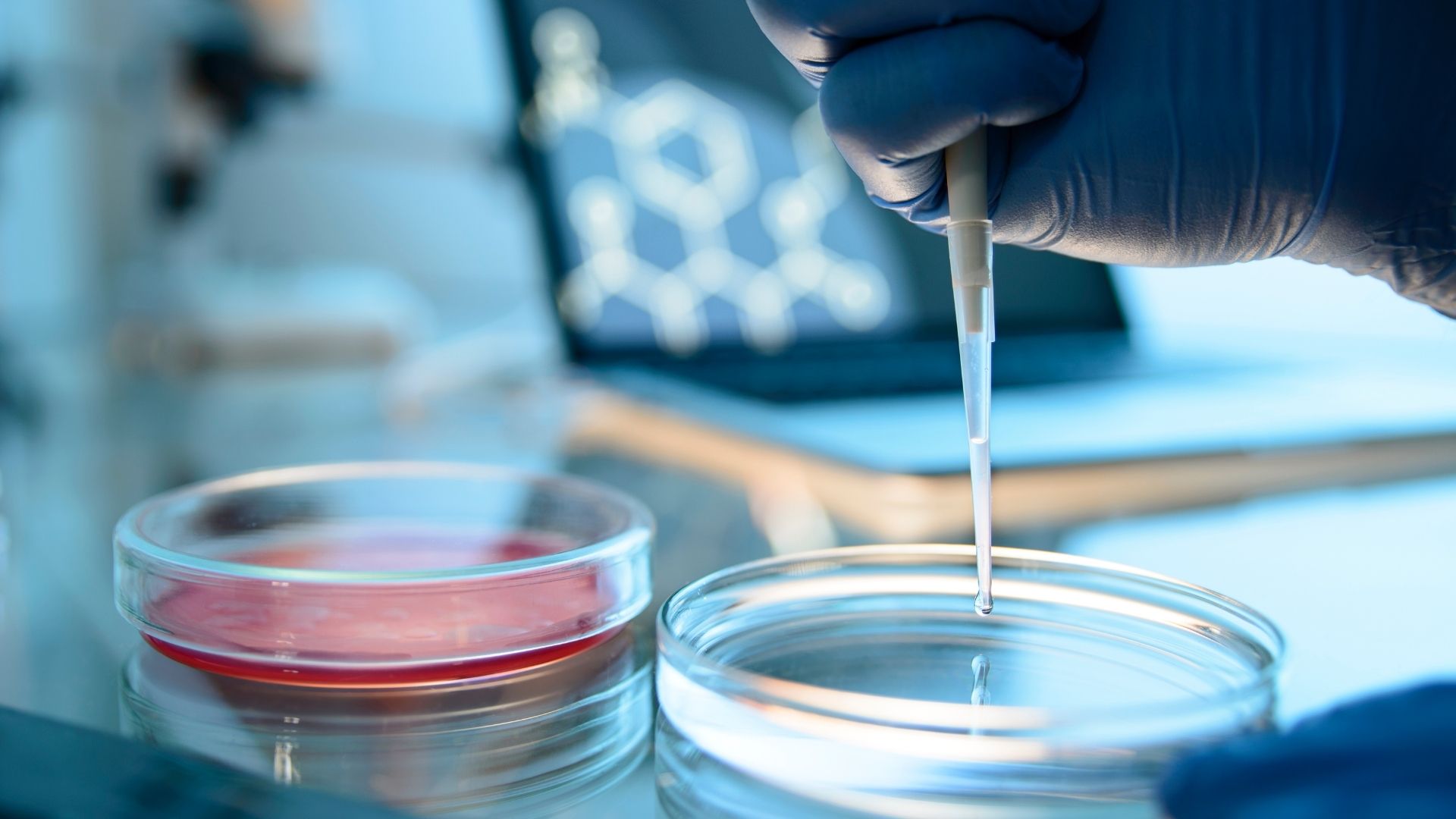 Microbiology lab at Qalitex